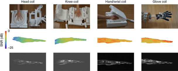 A High Impedance Detector Array Glove For Magnetic Resonance Imaging Of The Hand Nature Biomedical Engineering