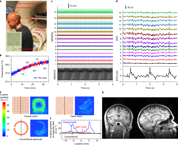 Large Area Mri Compatible Epidermal Electronic Interfaces For Prosthetic Control And Cognitive Monitoring Nature Biomedical Engineering