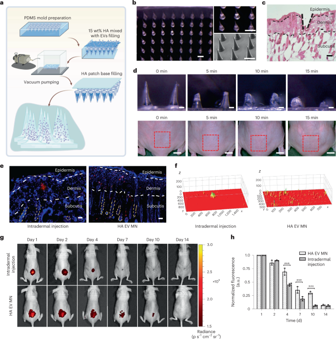 In Vivo Real-Time Imaging of Extracellular Vesicles in Liver Regeneration  via Aggregation-Induced Emission Luminogens