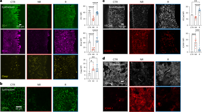 Fig. 5: The gut-on-a-chip distinguishes faecal microbiota of non-responsive patients from faecal microbiota of responsive patients.