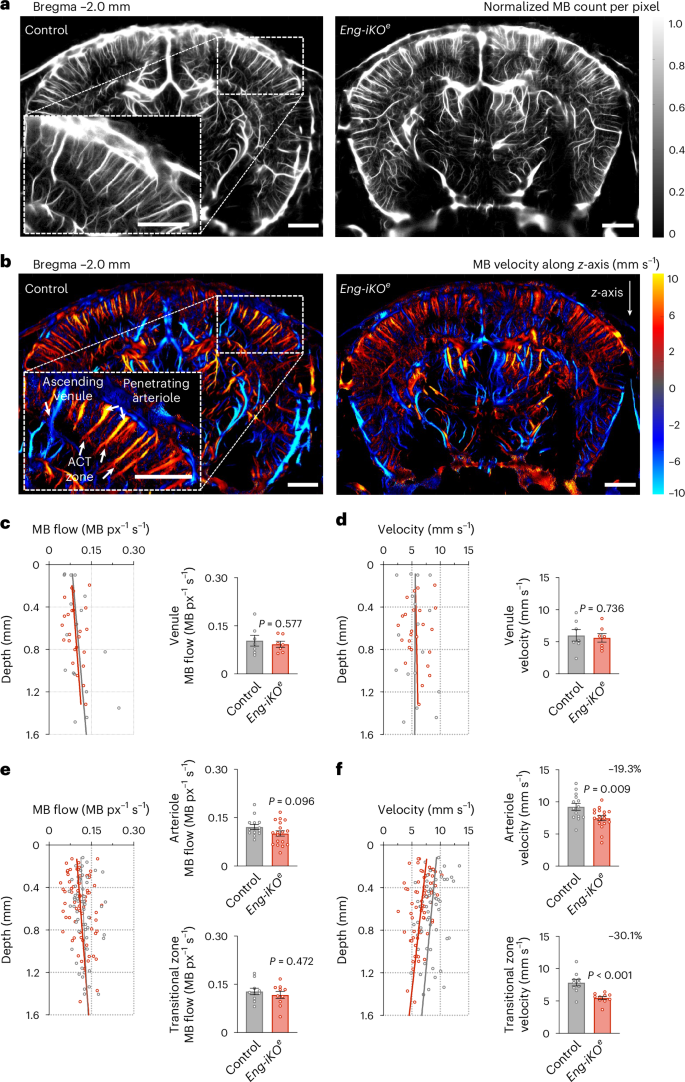 Fig. 2: ULM reveals cerebral arteriole abnormalities in Eng-iKOe mice.