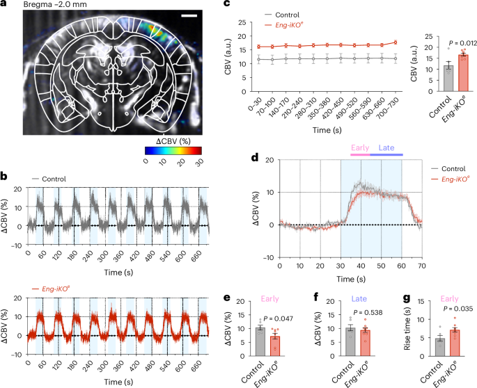 Fig. 4: Neurovascular uncoupling revealed by fUS.