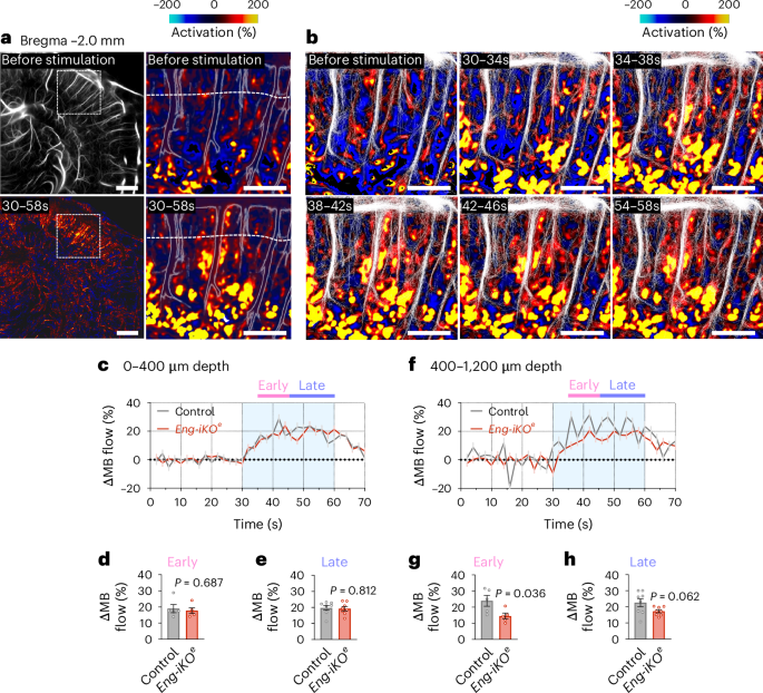 Fig. 5: Contractile pericyte dysfunction during the hyperaemic response revealed by fULM.