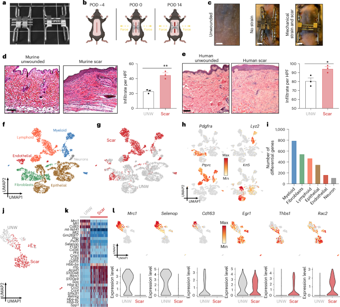 Fig. 1: Upregulation of mechanoresponsive macrophages in human-like murine model of scarring.