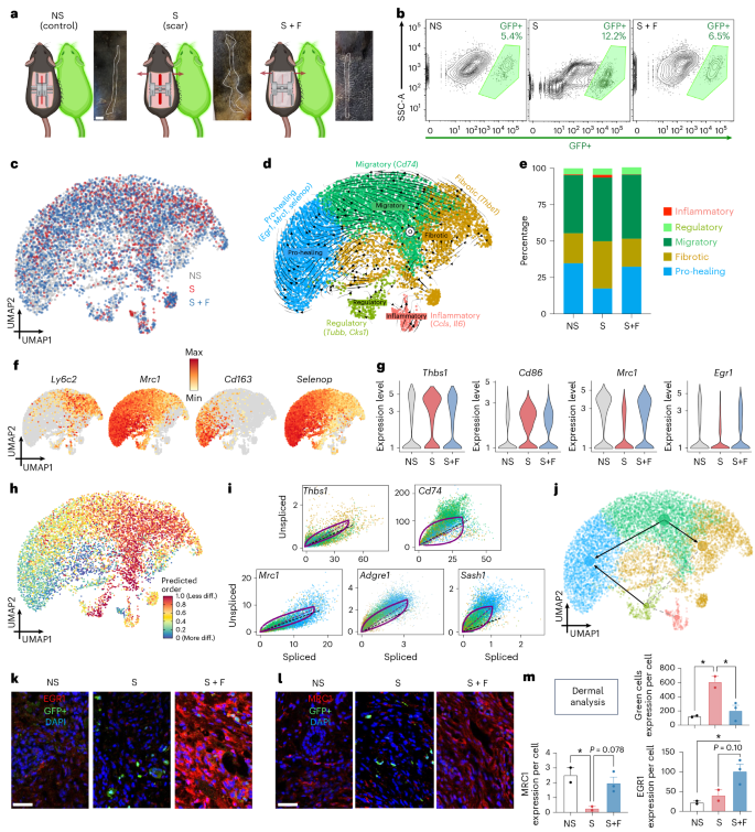 Fig. 3: Identification of circulating, mechanoresponsive myeloid cells which initiate fibrosis.