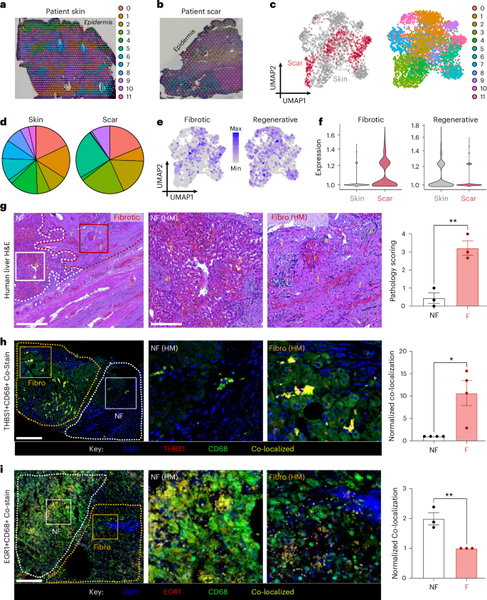 Fig. 5: Human confirmation of mechanoresponsive signal pathways.