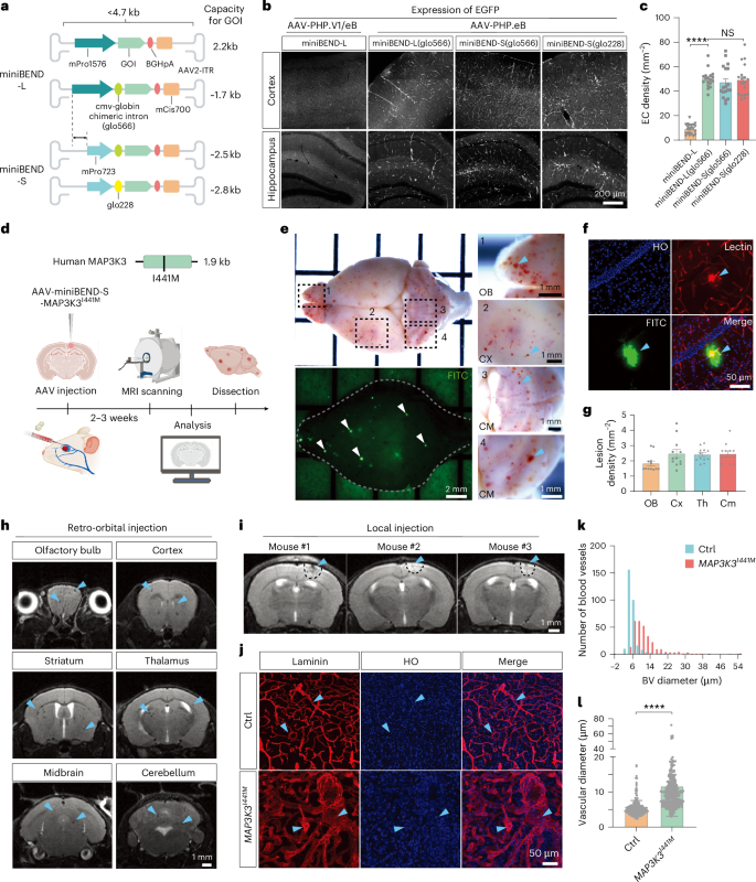 Fig. 3: Modelling of CCMs with the rAAV-miniBEND system.