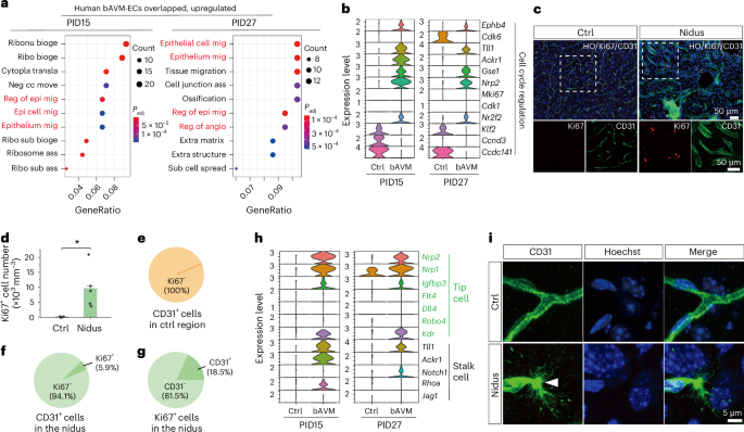 Fig. 7: Identification of key pathways or genes involved in bAVM onset and its progression.