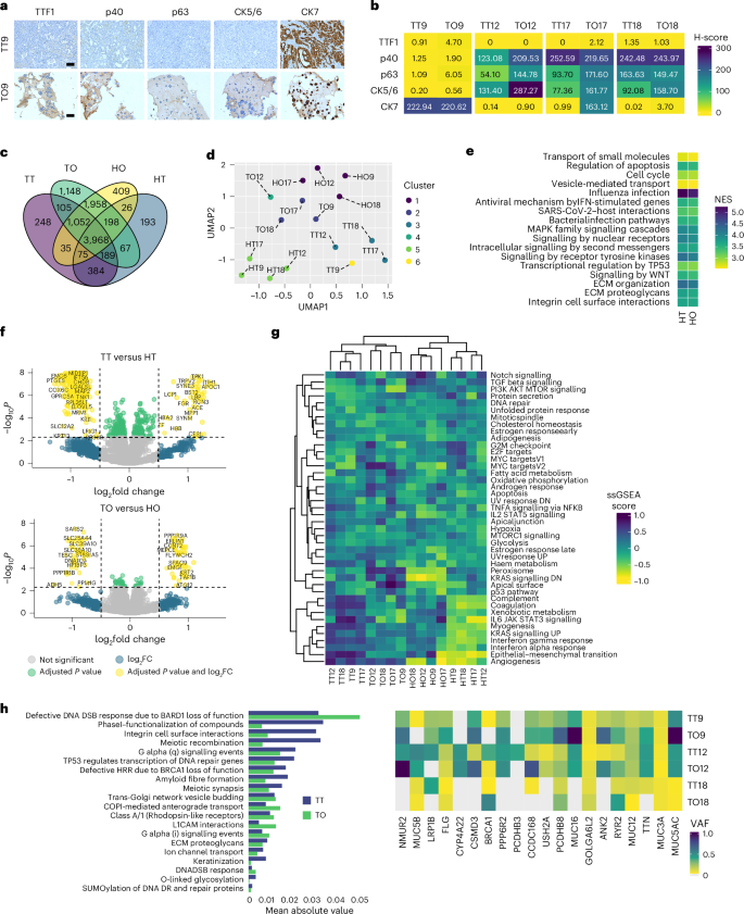 Fig. 2: Lung TOs preserve the histological and proteogenomic landscape of their parental tumours and enable individualized proteome profiling.