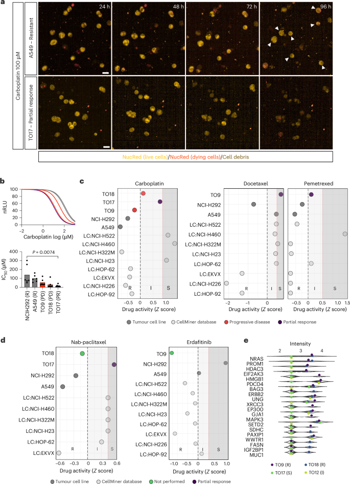 Fig. 3: Patients’ responses to therapies are retained in matched TOs.