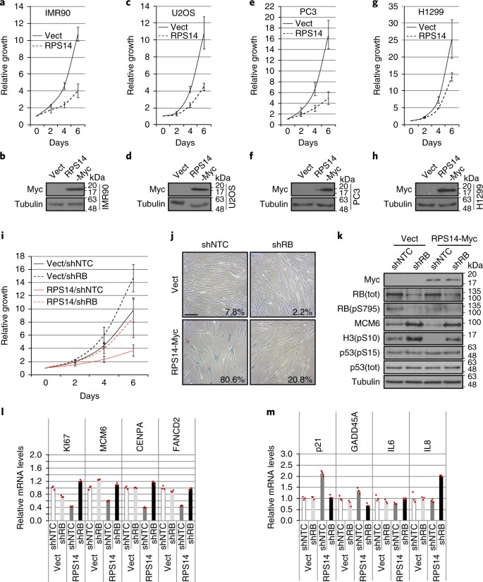 Senescence Associated Ribosome Biogenesis Defects Contributes To Cell Cycle Arrest Through The Rb Pathway Nature Cell Biology
