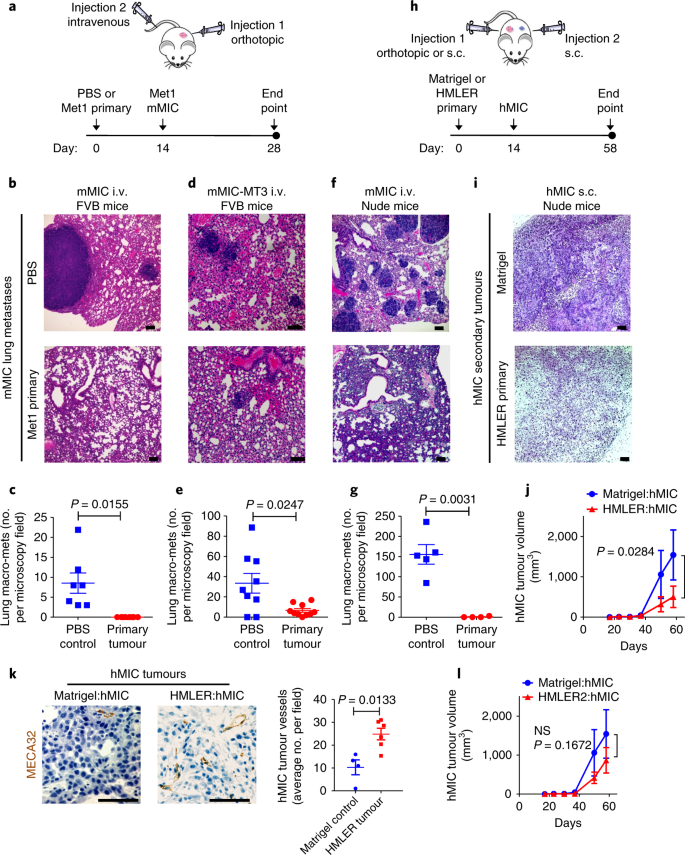 Il 1b Inflammatory Response Driven By Primary Breast Cancer Prevents Metastasis Initiating Cell Colonization Nature Cell Biology