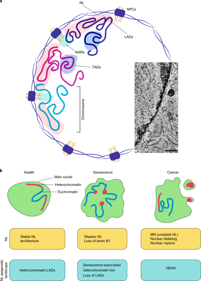 nuclear lamina progeria