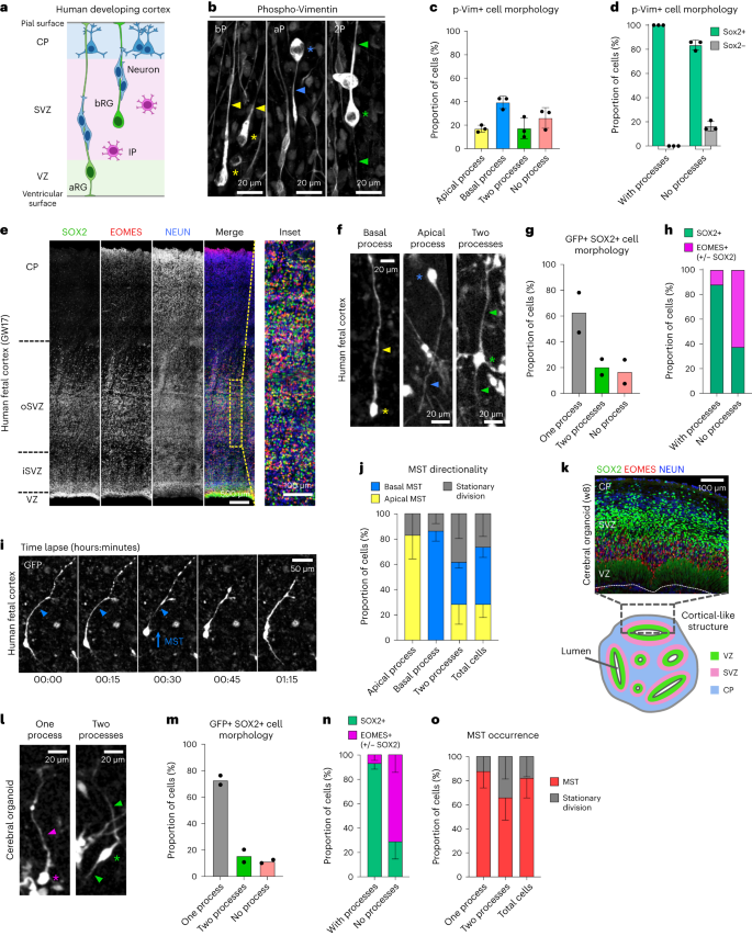 Fig. 1: Morphological characterization of bRG cells in human cerebral organoids and fetal tissue.