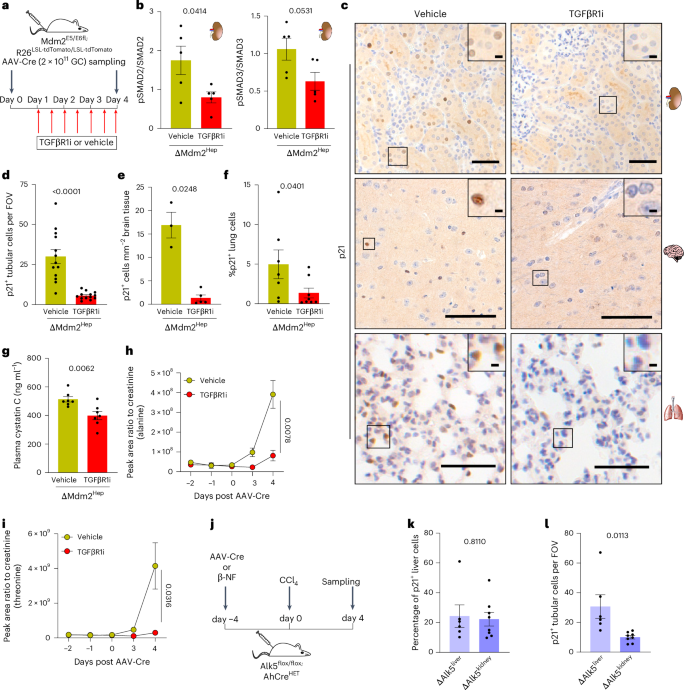 Fig. 5: Inhibition of TGFβ signalling prevents induction of senescence in the extrahepatic organs.