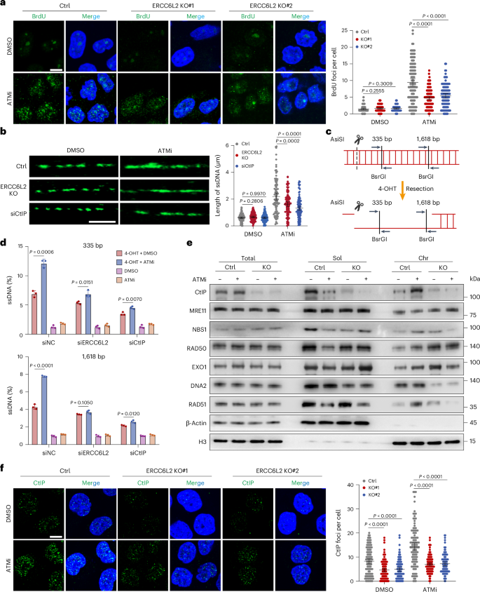 Fig. 3: ERCC6L2 deficiency reduces the excessive end resection induced by the ATMi.