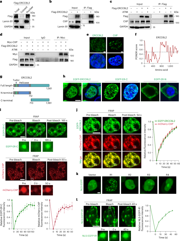 Fig. 4: ERCC6L2 interacts and forms dynamic condensates with CtIP.