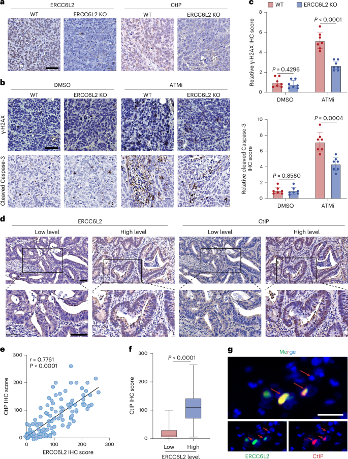 Fig. 8: KO of ERCC6L2 reduces DNA damage induced by the ATMi.