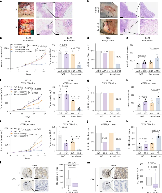 Fig. 1: PAT confers tumour ferroptosis resistance and reduces immunotherapy efficacy.
