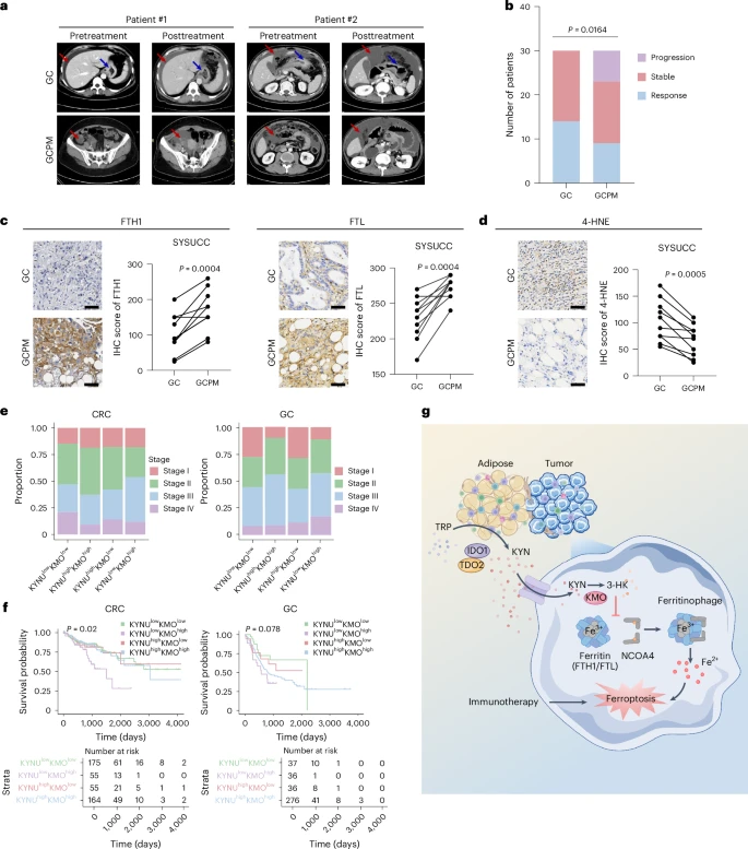 Fig. 7: PAT-associated ferritin regulatory axis correlates with malignancy and ICB response.