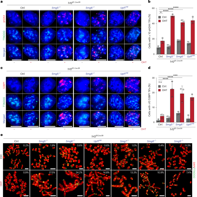 Fig. 2: NMD is required for telomere protection in the absence of TRF2.