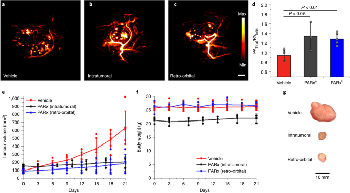 glutathione and lung cancer Photoacoustic imaging of elevated glutathione in models of lung cancer for companion diagnostic applications glutathione and lung cancer Photoacoustic imaging of elevated glutathione in models of lung cancer for companion diagnostic applications