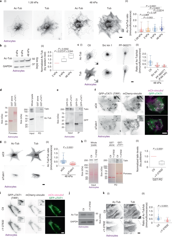 Microtubules Tune Mechanosensitive Cell Responses Nature Materials