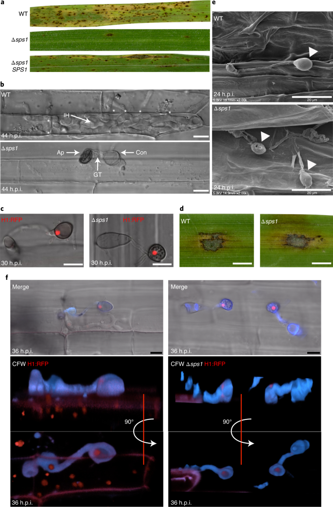 Spermine Mediated Tight Sealing Of The Magnaporthe Oryzae Appressorial Pore Rice Leaf Surface Interface Nature Microbiology