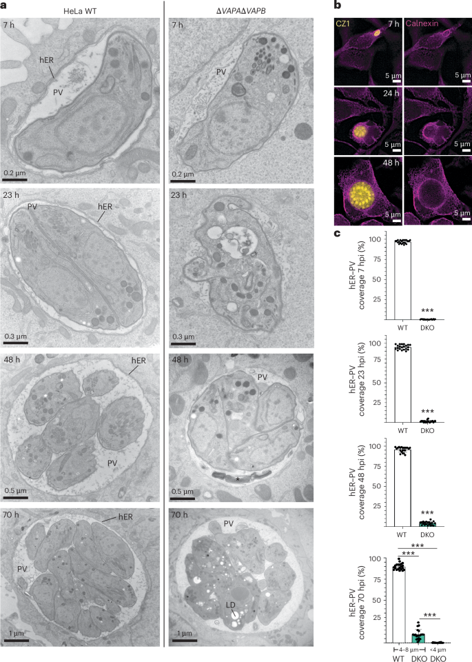 Fig. 3: No hER recruitment of the type II CZ1 strain in HeLa ∆VAPA∆VAPB.