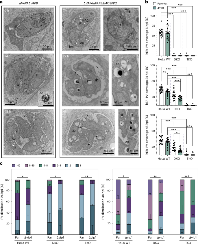 Fig. 6: Ultrastructure of ∆TgVIP1 parasites in cell lines deficient in VAPA, VAPB and/or MOSPD2.