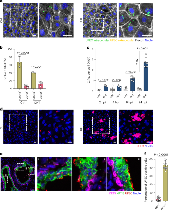 Fig. 2: UPEC preferentially invades and replicates in cells within the 2D organoid-based model grown in the presence of DHT.