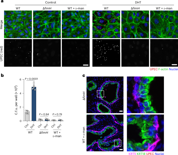Fig. 3: FimH is necessary for maximal invasion into differentiated prostate cells.