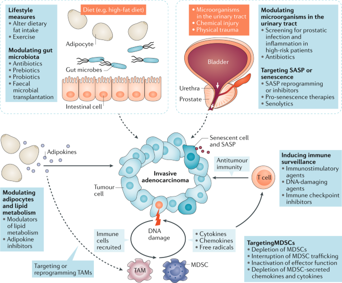 prostate cancer review nature)
