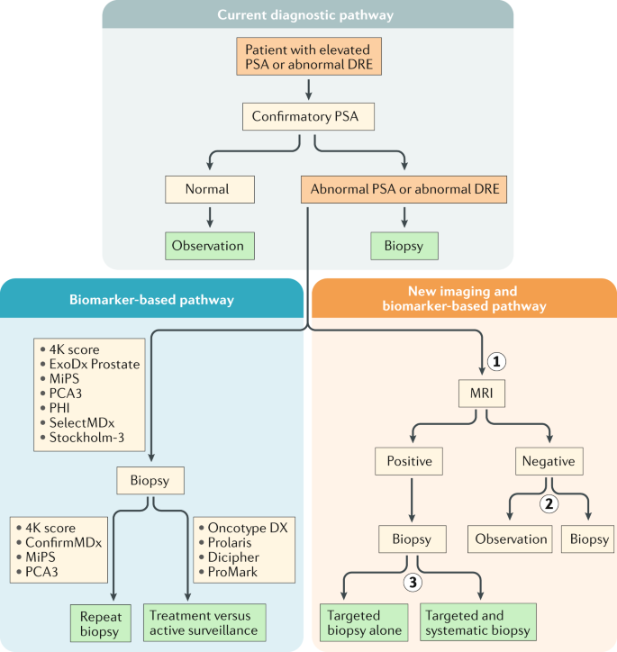 diagnosticul prostatei)