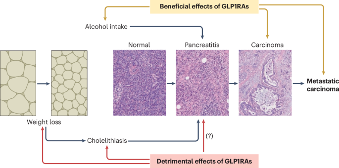 tirzepatide cancer risk Glucagon-like peptide 1 receptor agonists and cancer risk: the good, the  bad and the unknown