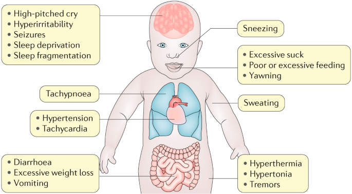 Neonatal abstinence syndrome (NAS)