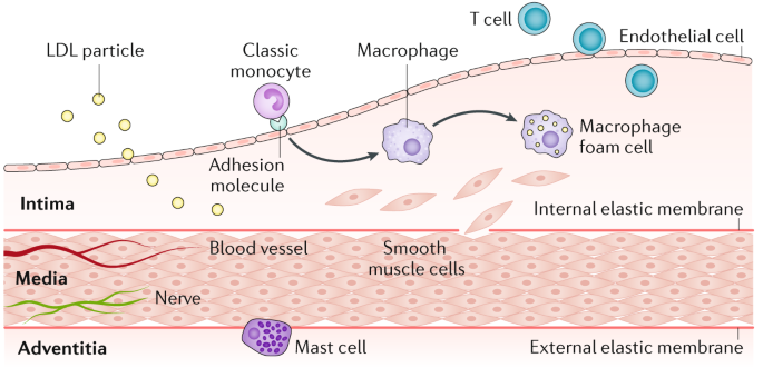 isolation Jurassic Park lukker Atherosclerosis | Nature Reviews Disease Primers