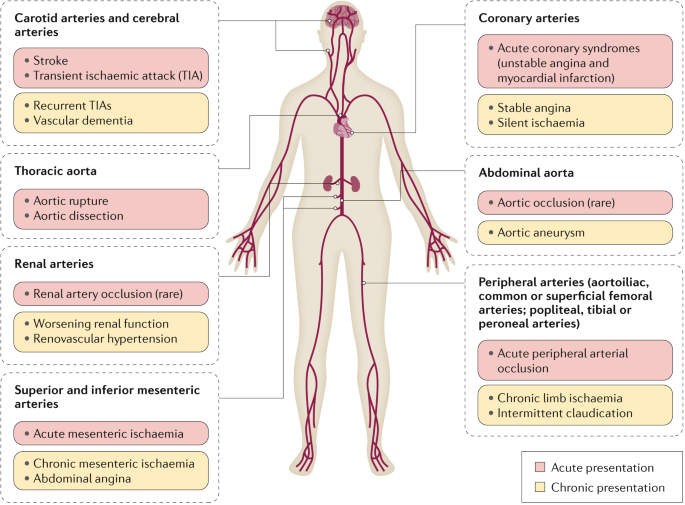 Atherosclerosis Nature Reviews Disease Primers