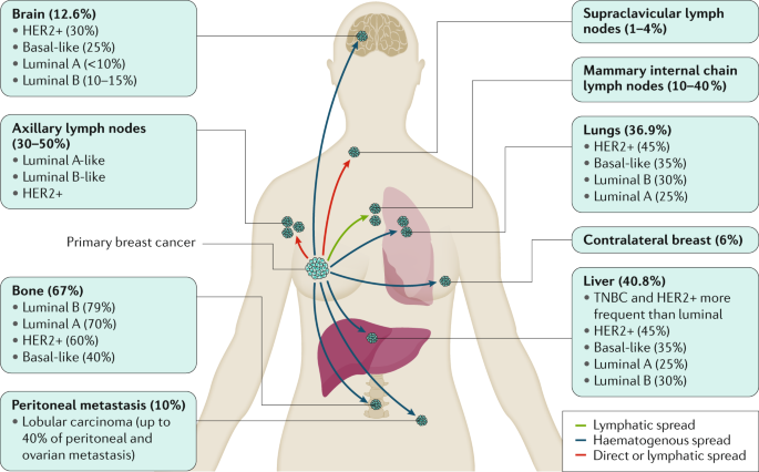 Breast cancer | Nature Reviews Disease Primers