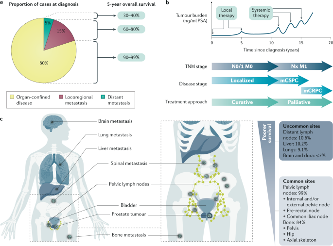 prostate cancer review nature)