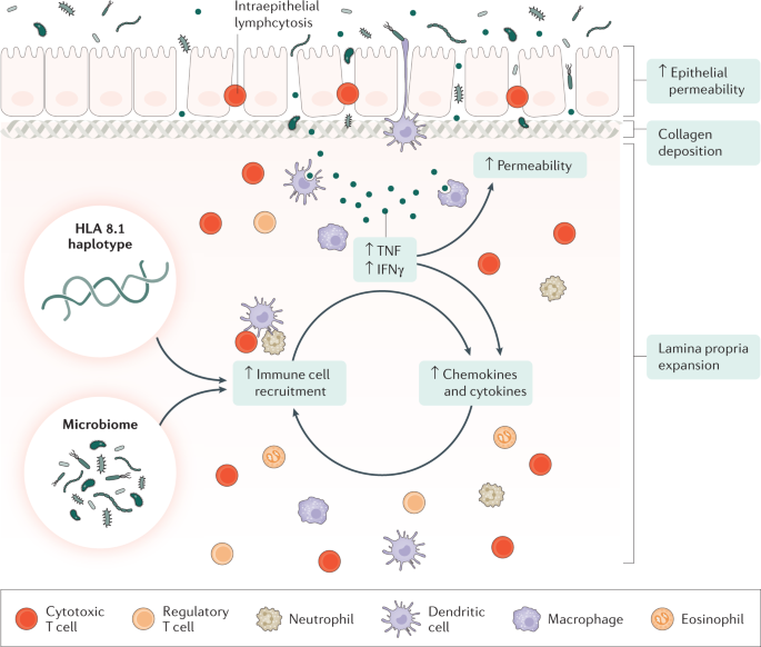 Microscopic colitis | Nature Reviews Disease Primers