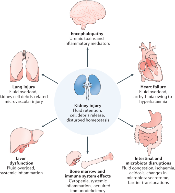 Pathophysiology of acute kidney injury