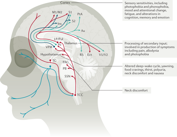 glutathione and migraines Migraine