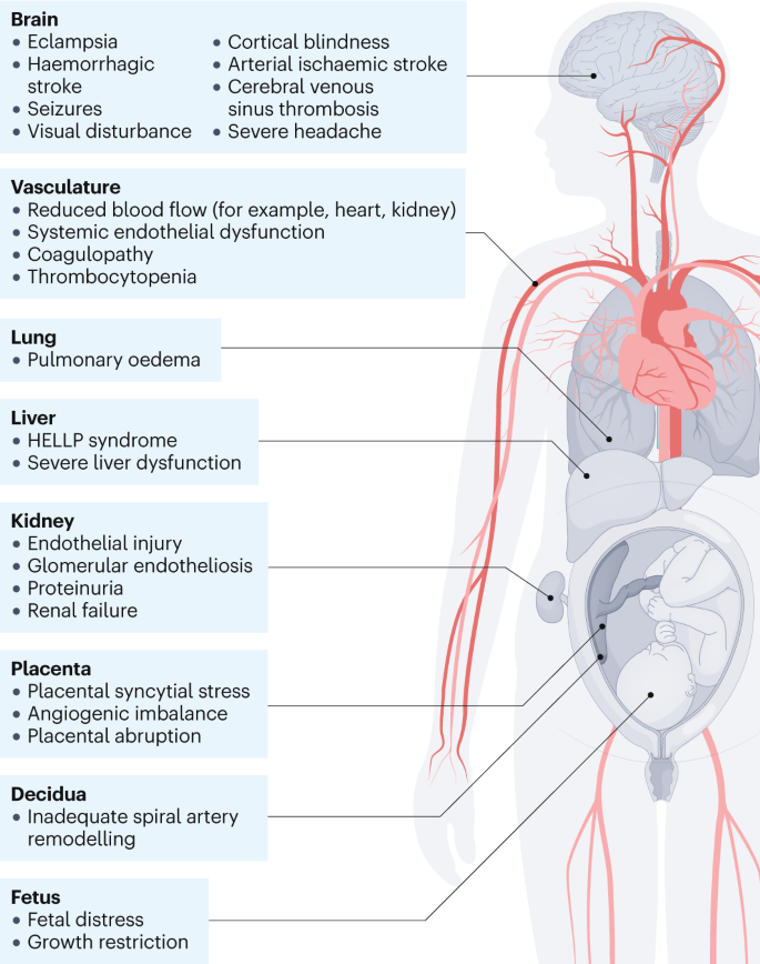 Oral antihypertensive regimens (nifedipine retard, labetalol, and  methyldopa) for management of severe hypertension in pregnancy: an  open-label, randomised controlled trial - The Lancet