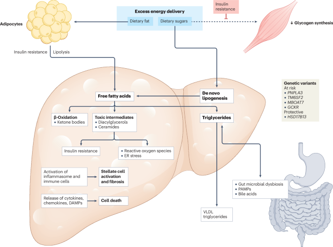 Metabolic dysfunction-associated steatotic liver disease in adults | Nature Reviews Disease Primers Metabolic dysfunction-associated steatotic liver disease in adults | Nature Reviews Disease Primers