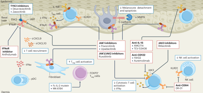 Vitiligo | Nature Reviews Disease Primers
