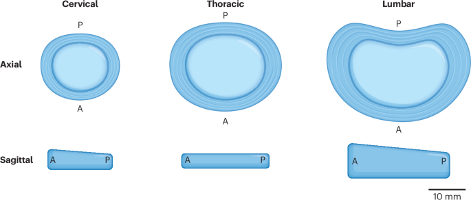نسبة الفقرة إلى القرص بين الفقرات
