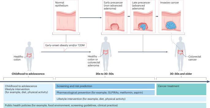 Early-onset colorectal cancer as an emerging disease of metabolic  dysregulation