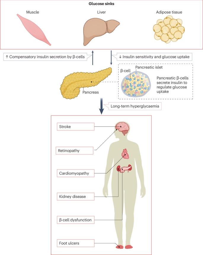 Models of hyperglycaemia in diabetes mellitus and its complications ...