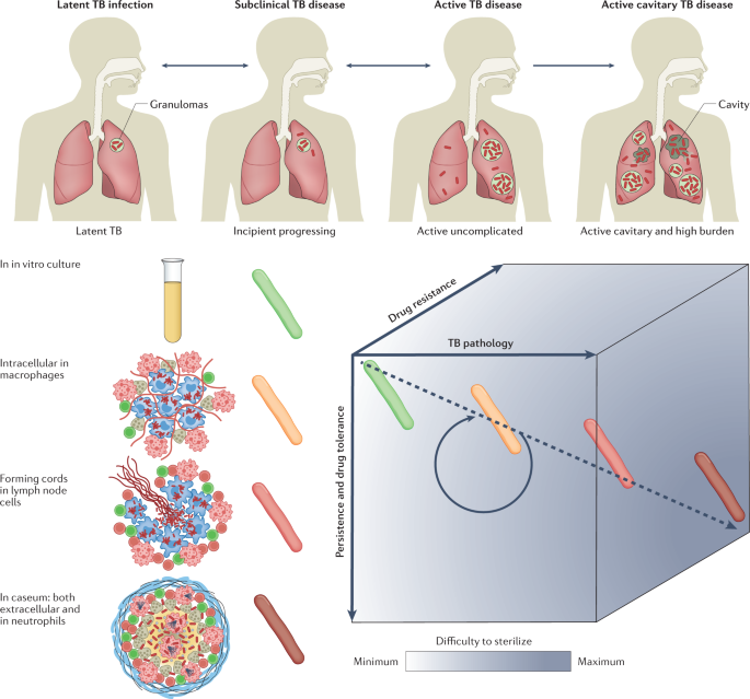 research articles on pulmonary tuberculosis figure 2